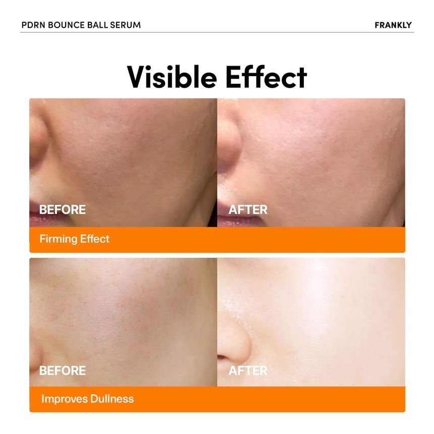 FRANKLY - PDRN Bounce Ball Serum 30ml - Image 2